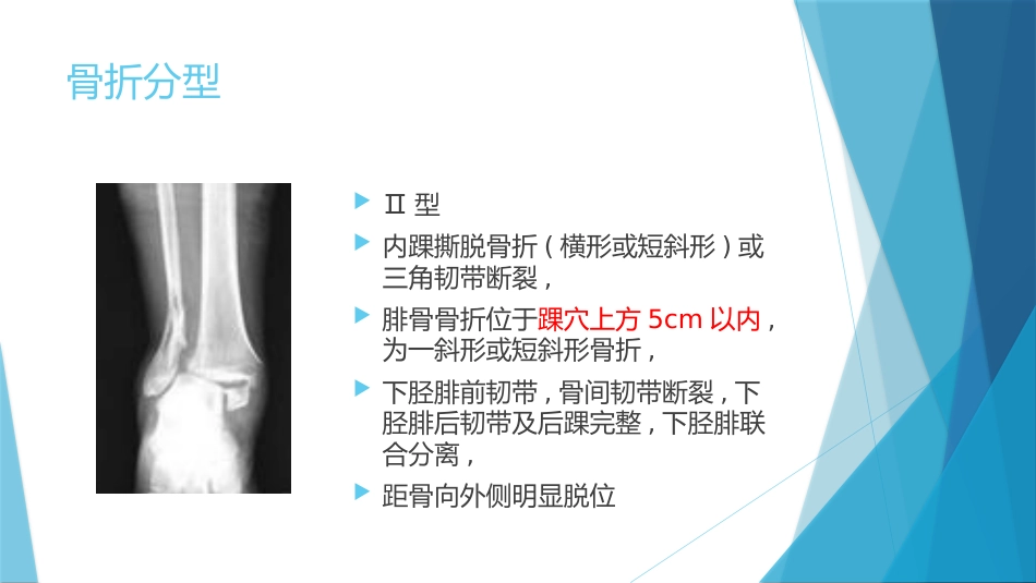 特殊类型的踝关节骨折（下）_第7页