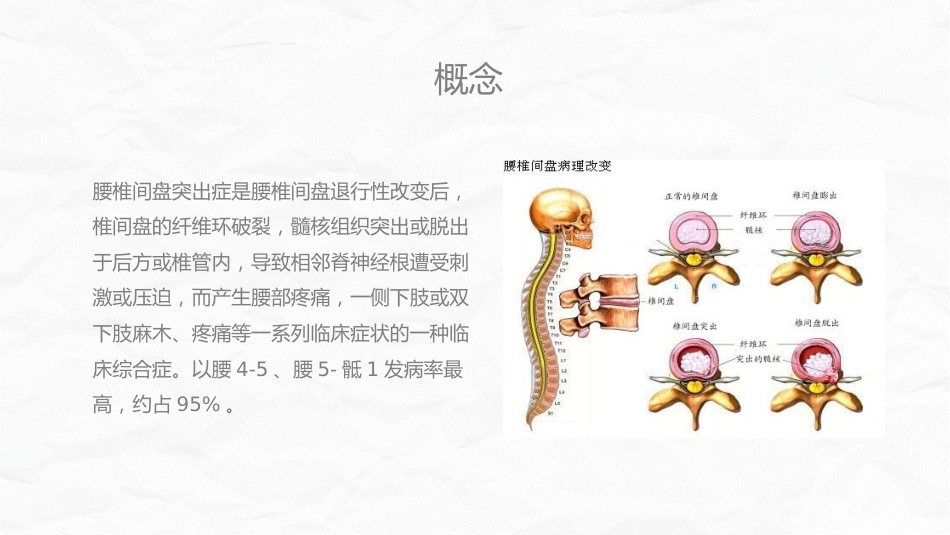 腰椎间盘突出症中医护理_第4页