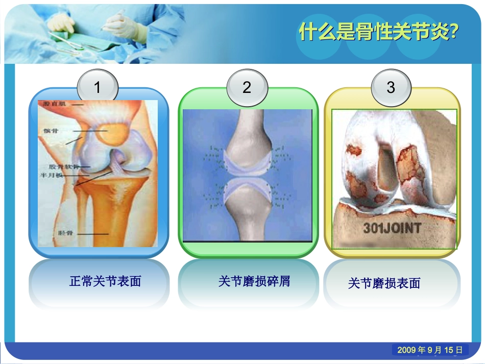 老年性骨性关节炎_第7页