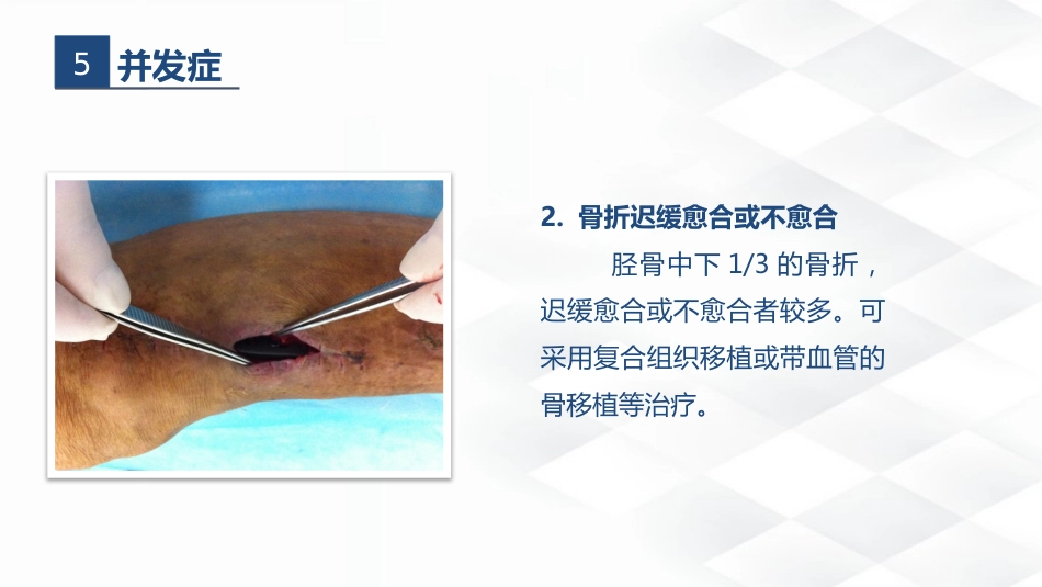 骨科-胫腓骨骨折教育查房_第10页