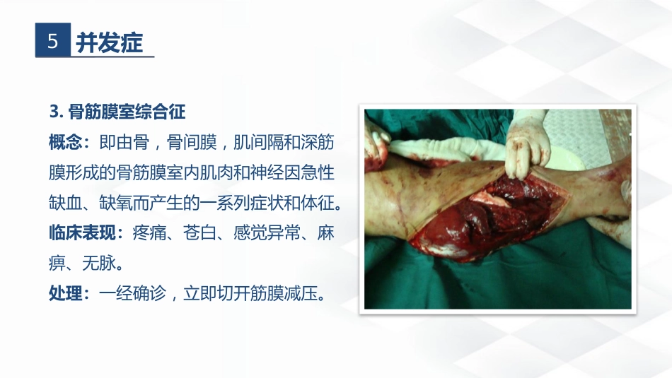 骨科-胫腓骨骨折教育查房_第11页