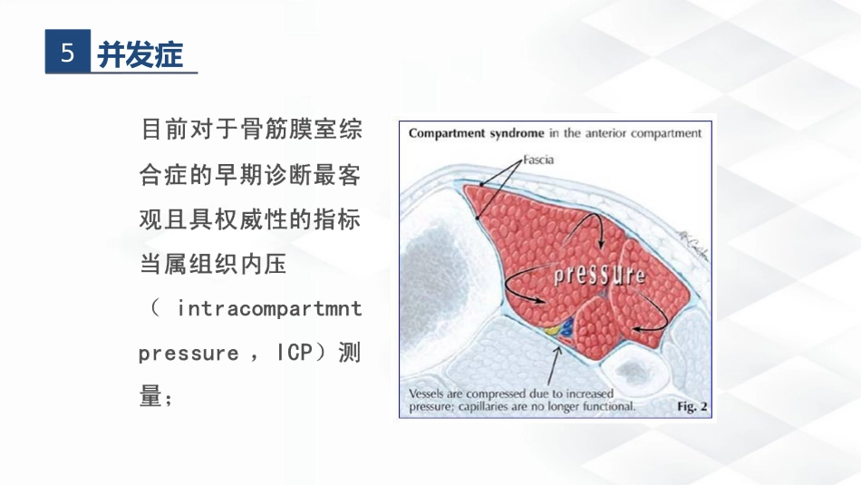 骨科-胫腓骨骨折教育查房_第12页
