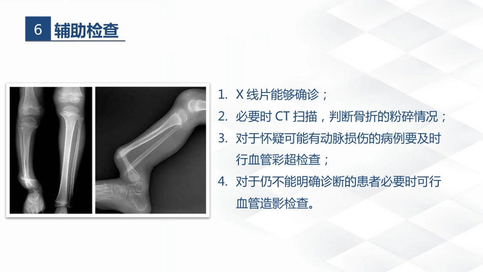 骨科-胫腓骨骨折教育查房_第13页
