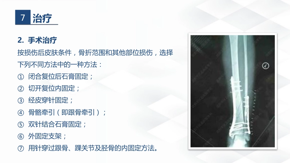 骨科-胫腓骨骨折教育查房_第15页