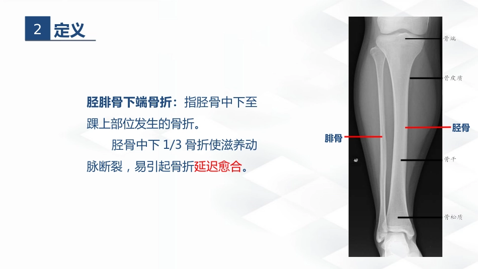 骨科-胫腓骨骨折教育查房_第5页
