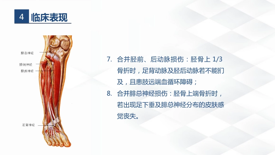 骨科-胫腓骨骨折教育查房_第8页
