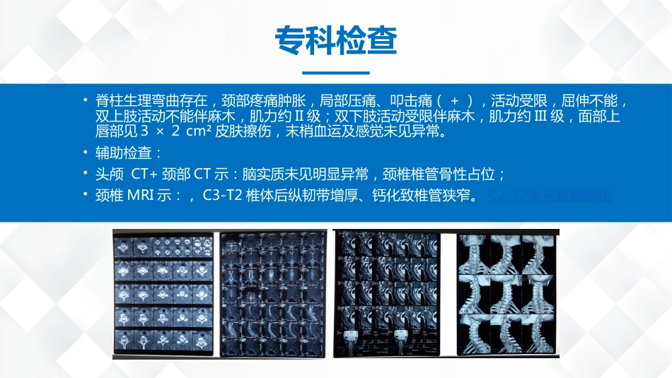 脊柱骨科-脊髓损伤护理查房_第6页