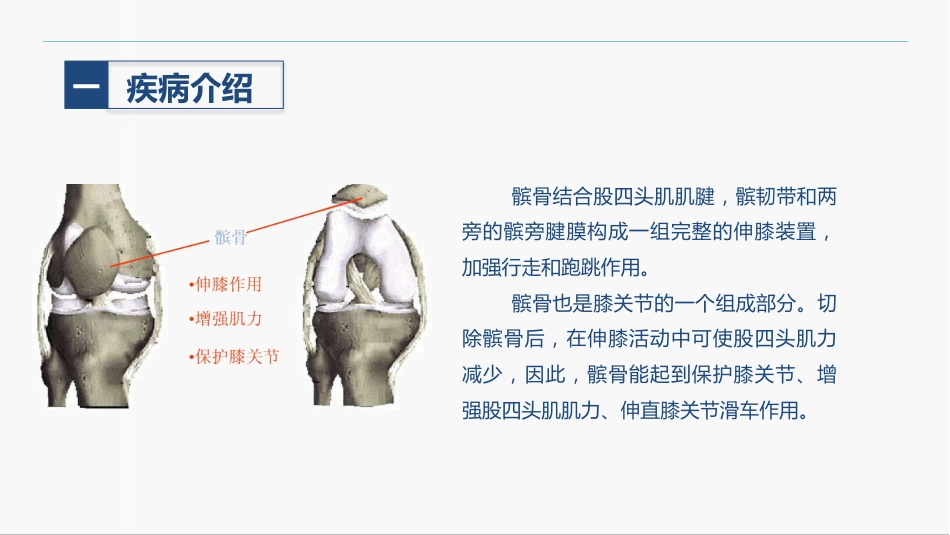 髌骨骨折的护理查房_第4页