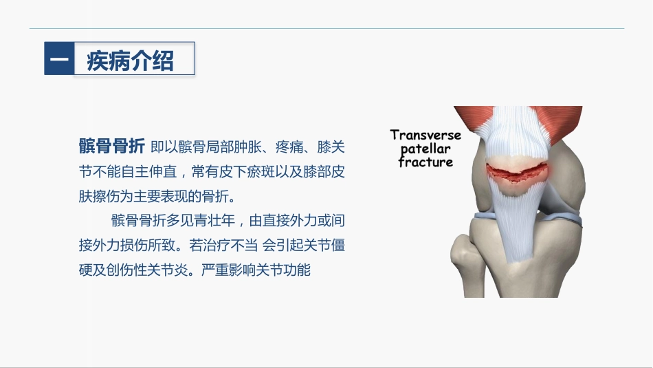 髌骨骨折的护理查房_第5页