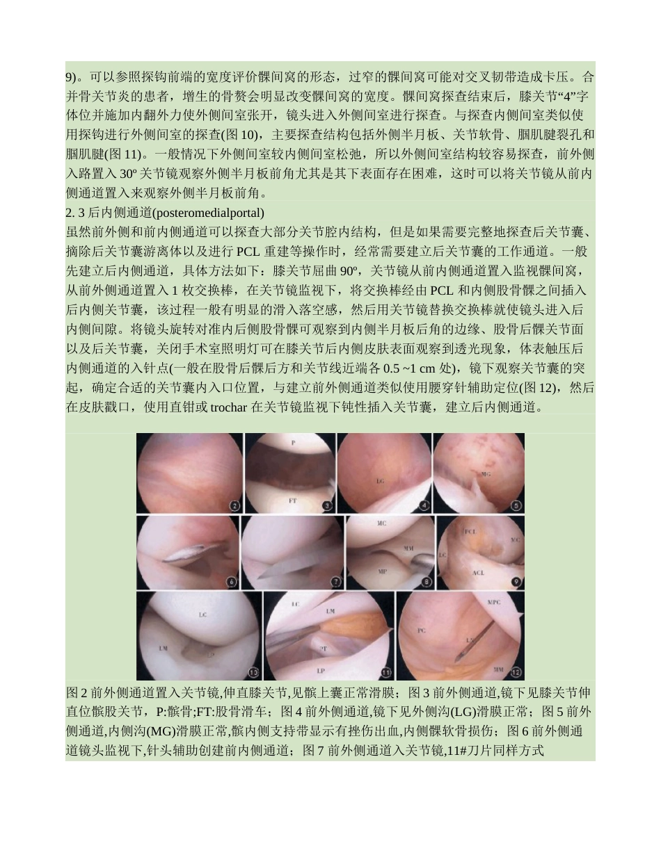膝关节镜手术入路的技巧及相关解剖概要_第3页