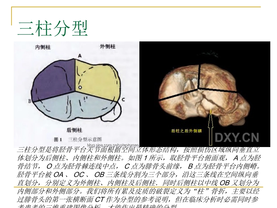 胫骨平台骨折的分型与治疗_第10页