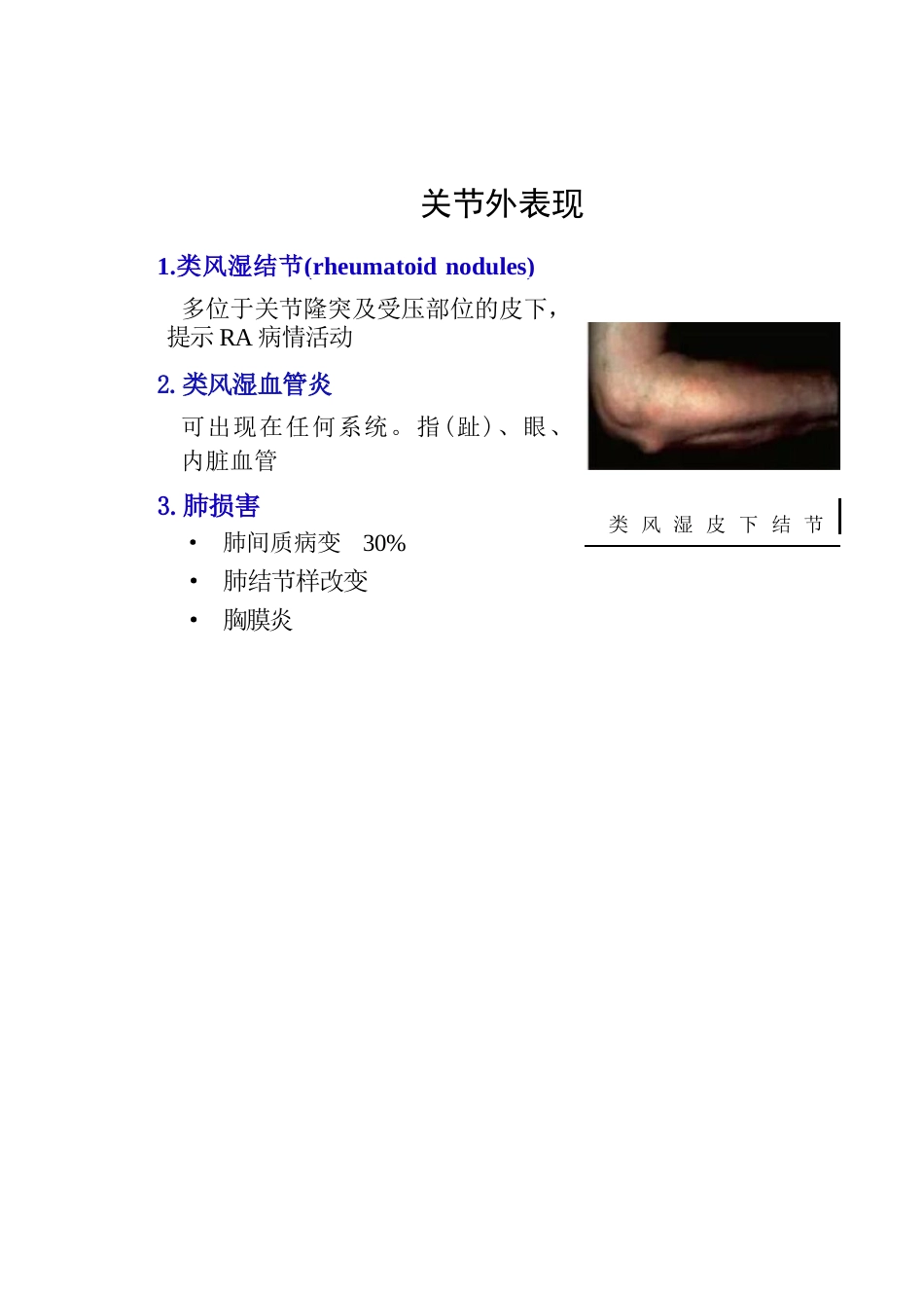 类风湿性关节炎的诊断及治疗策略_第14页