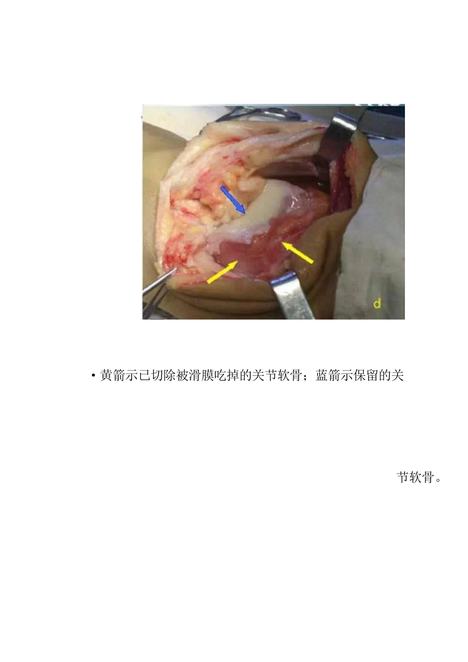 类风湿性关节炎的诊断及治疗策略_第6页