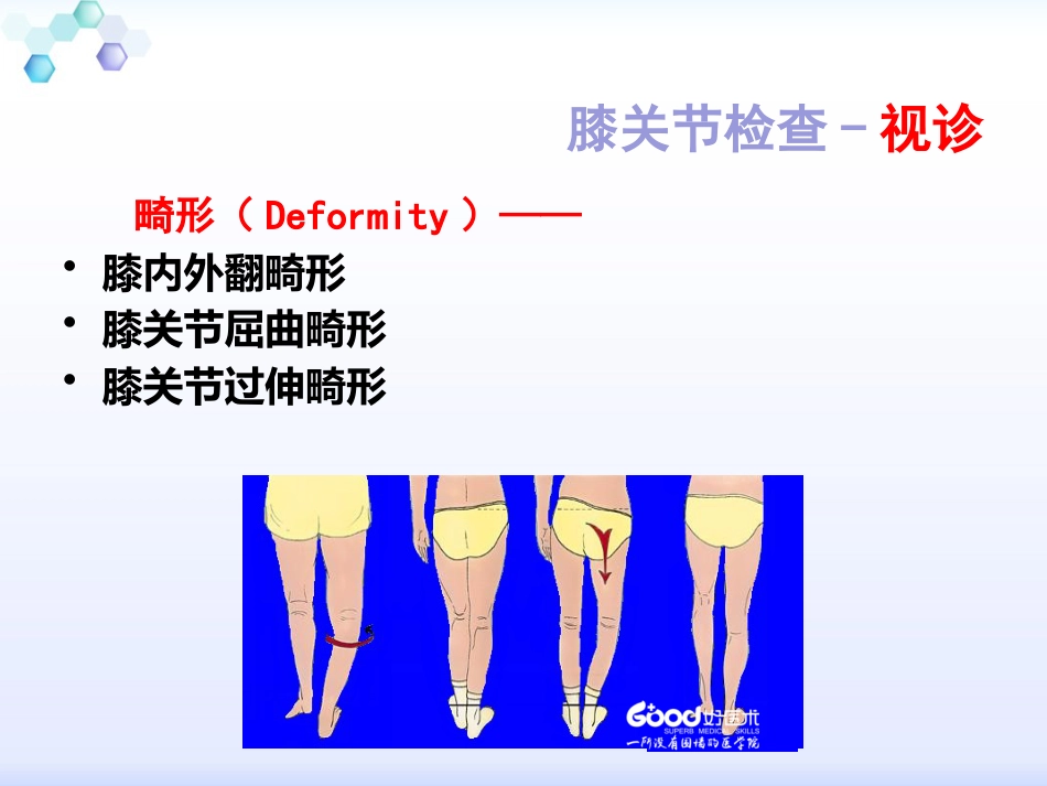 膝关节体格检查1_第12页