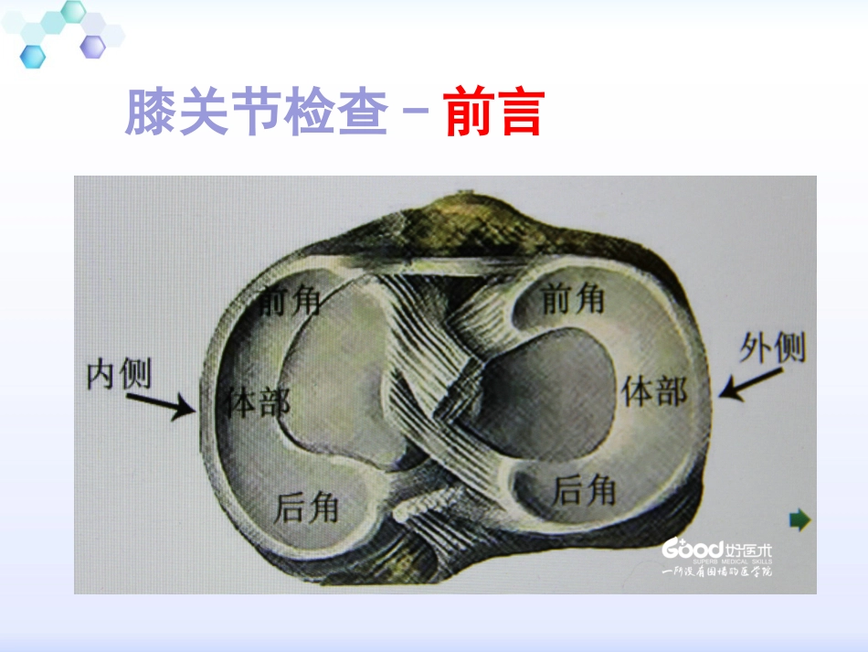 膝关节体格检查1_第4页