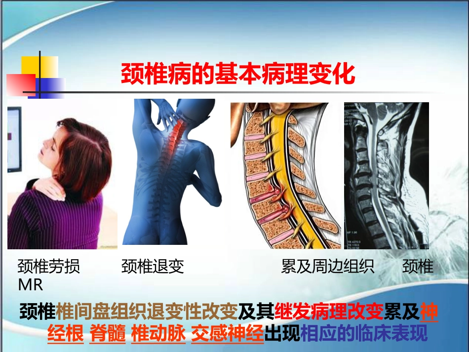 颈椎病的诊断与治疗(1)_第11页