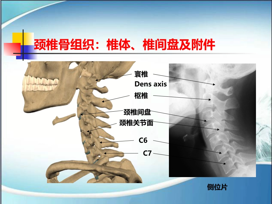 颈椎病的诊断与治疗(1)_第6页