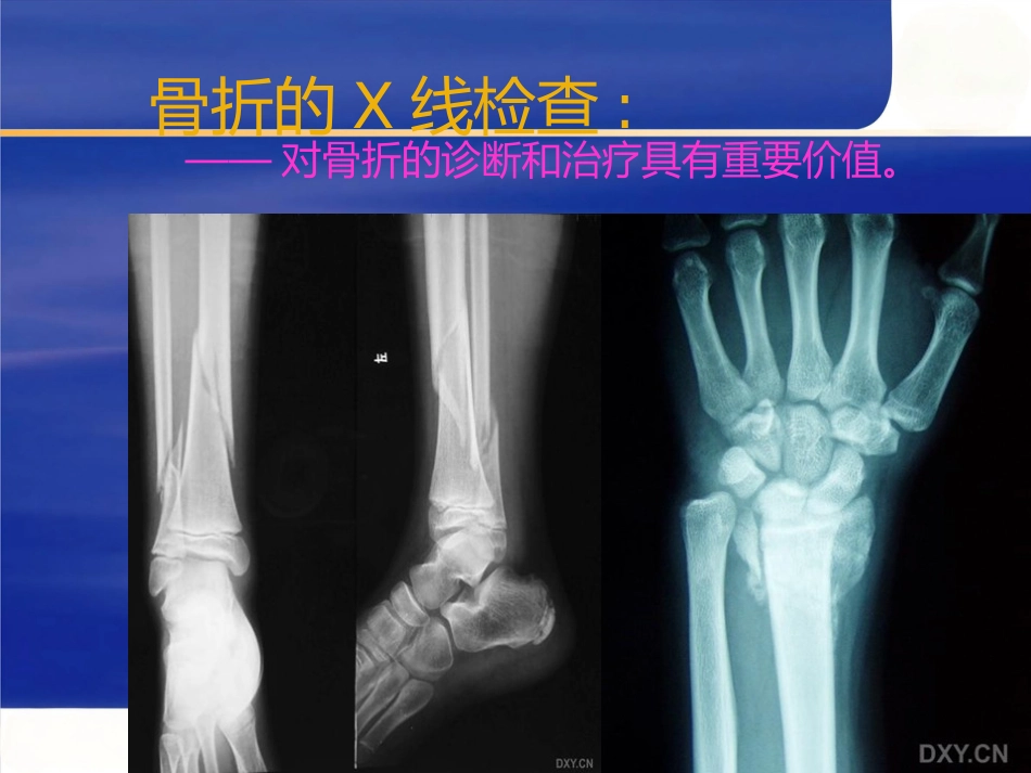 骨科创伤的急救处理(1)_第11页