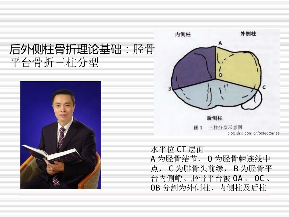 胫骨平台骨折 (1)_第11页