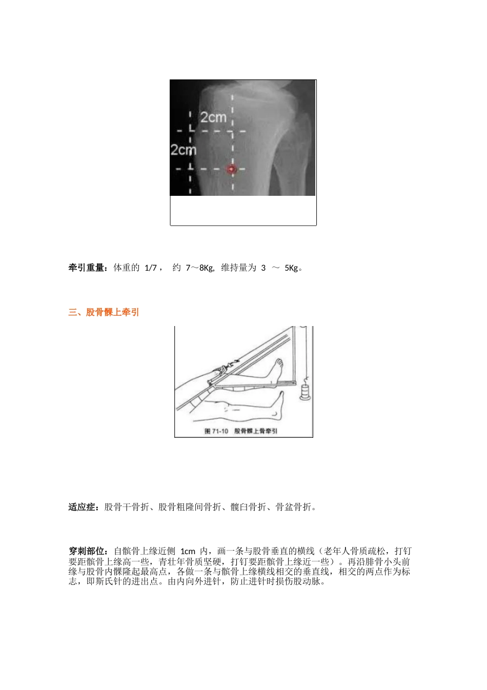 骨科牵引术(1)_第5页