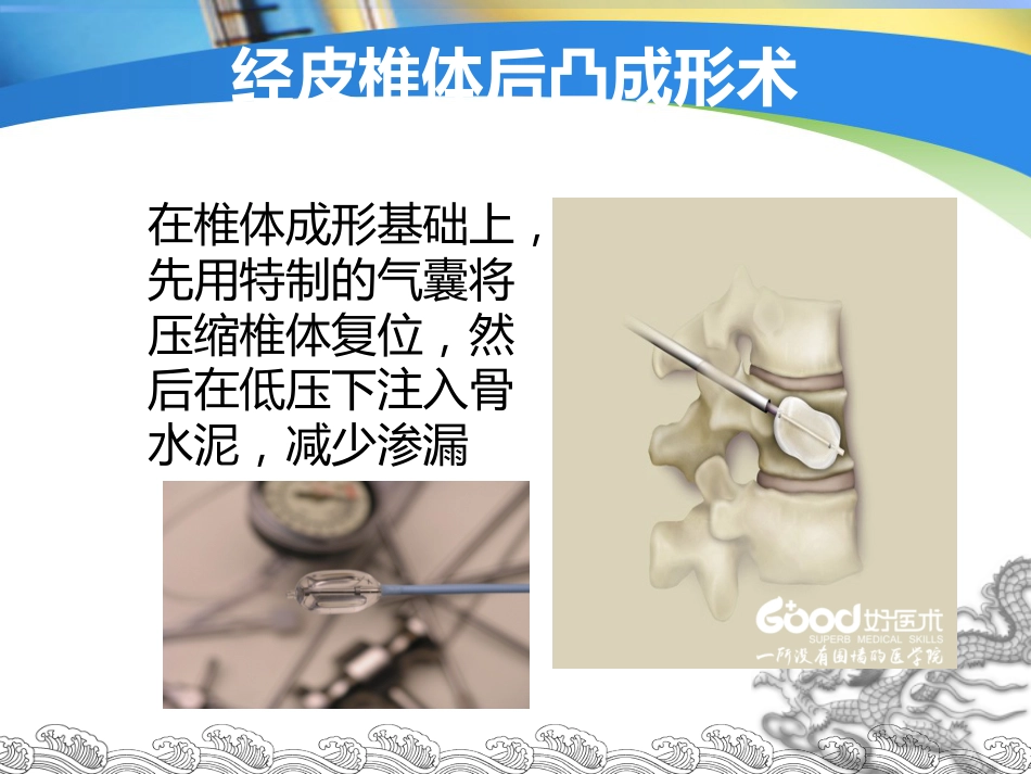 胸腰椎骨折的微创手术治疗(1)_第6页
