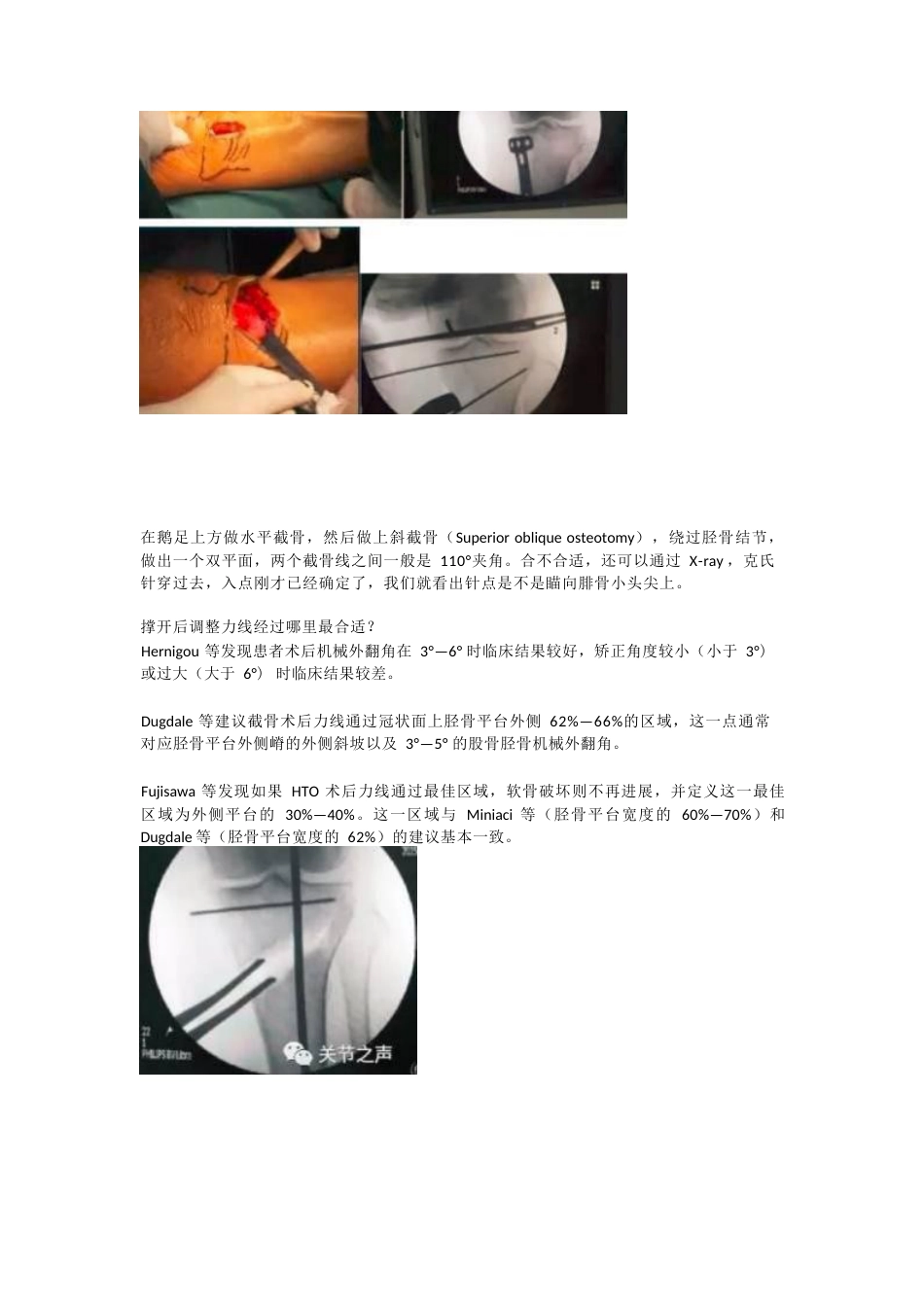 胫骨高位截骨术(1)_第15页