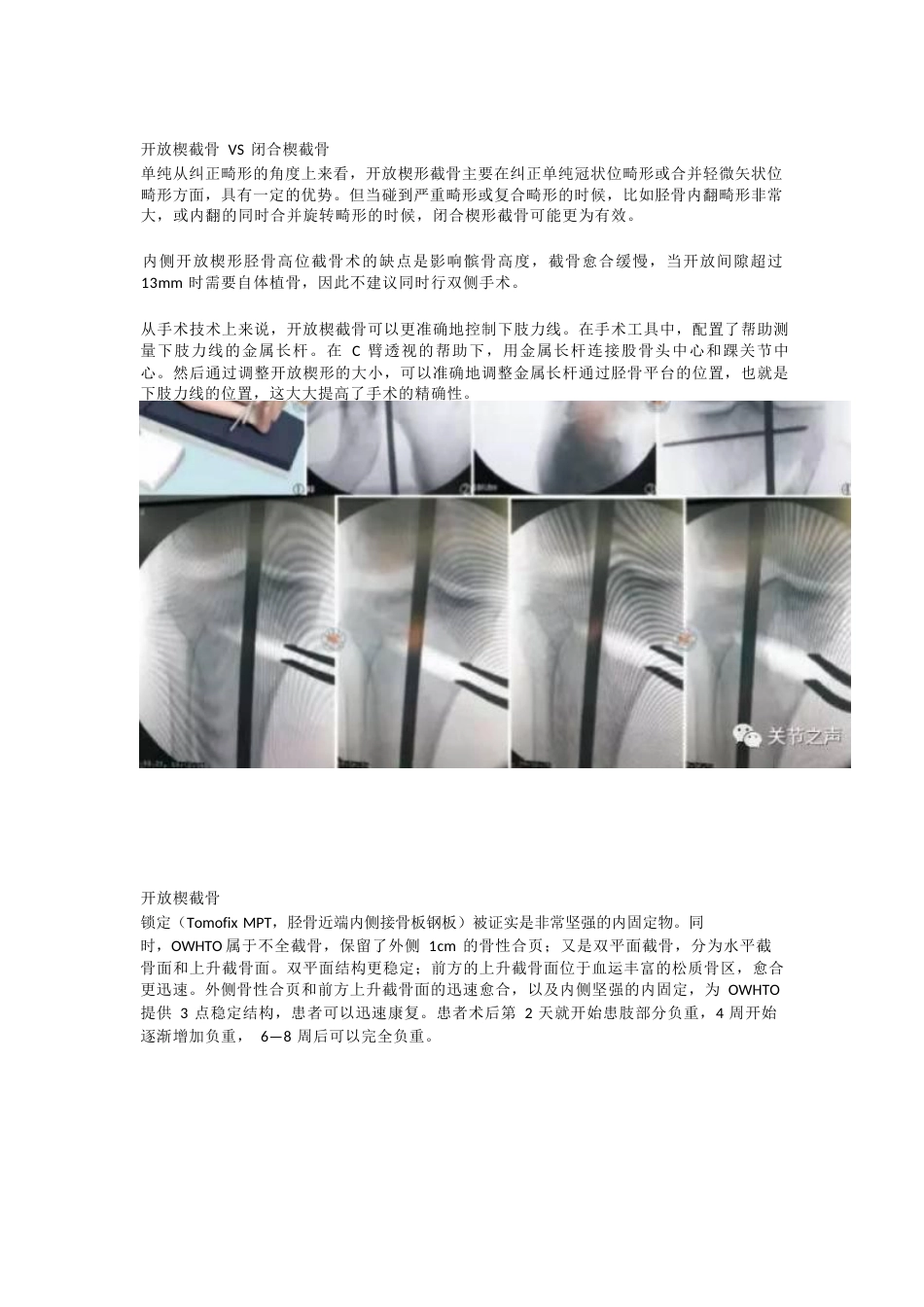 胫骨高位截骨术(1)_第6页