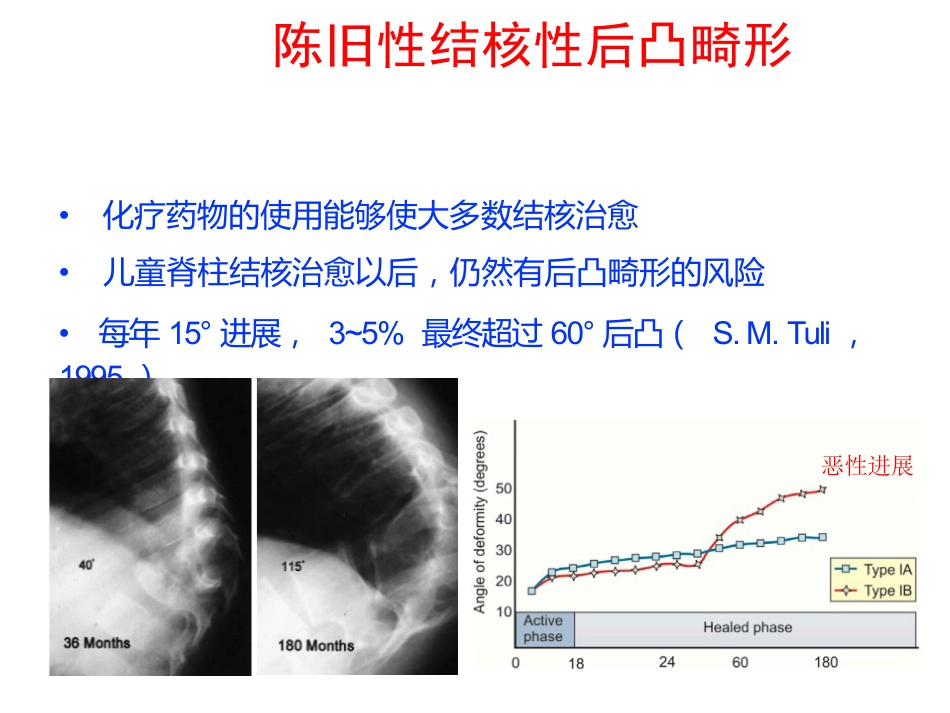 陈旧性结核后凸的手术治疗(1)_第2页