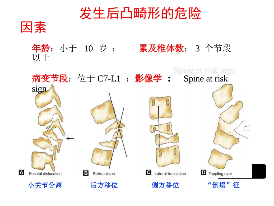 陈旧性结核后凸的手术治疗(1)_第3页