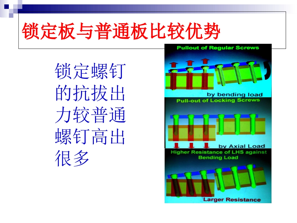 锁定钢板的应用及注意事项(1)_第10页