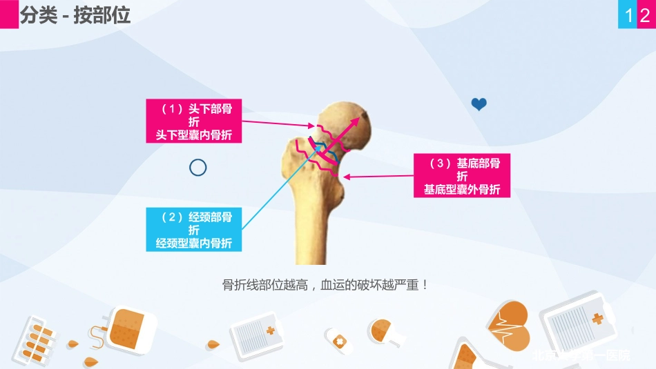 骨科-股骨颈骨折护理查房 (2)_第12页
