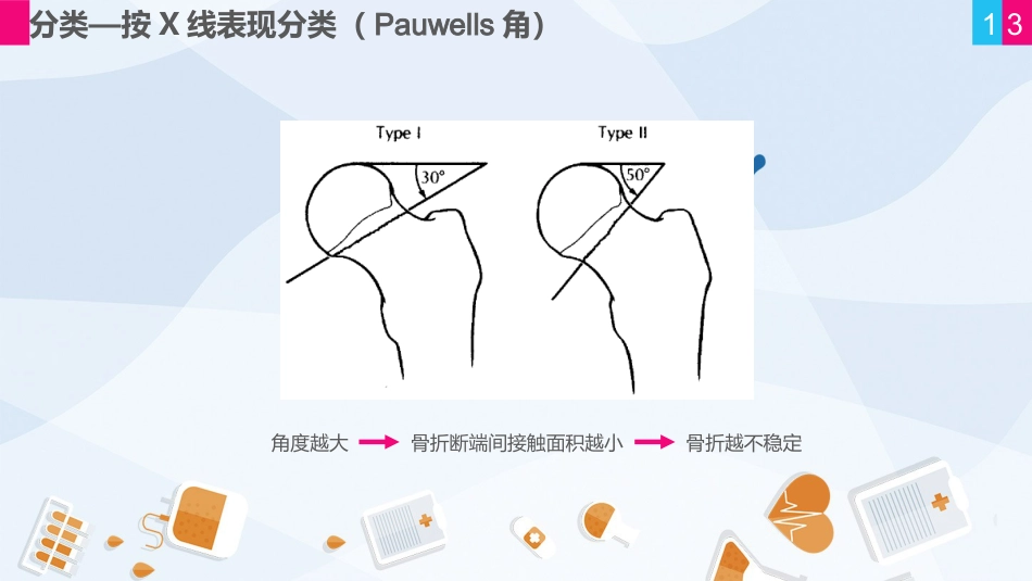 骨科-股骨颈骨折护理查房 (2)_第13页