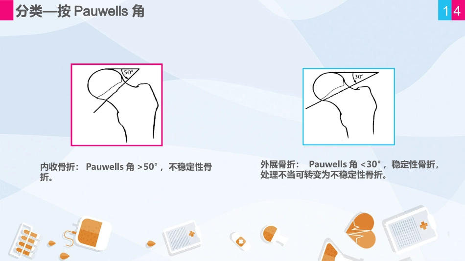 骨科-股骨颈骨折护理查房 (2)_第14页