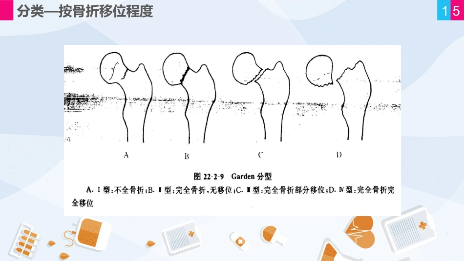 骨科-股骨颈骨折护理查房 (2)_第15页