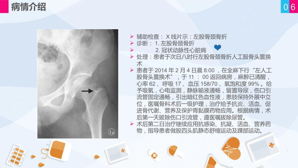 骨科-股骨颈骨折护理查房 (2)_第6页