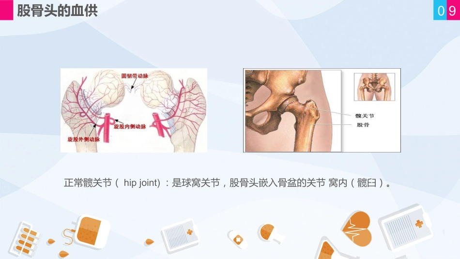 骨科-股骨颈骨折护理查房 (2)_第9页