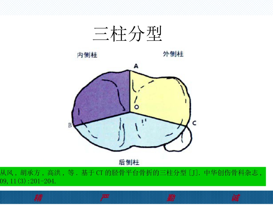 胫骨后外侧平台骨折处理-2(1)_第9页