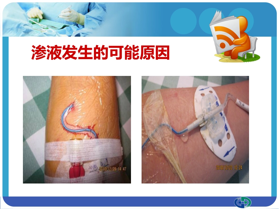 PICC穿刺点渗液与皮肤过敏的处理_第11页