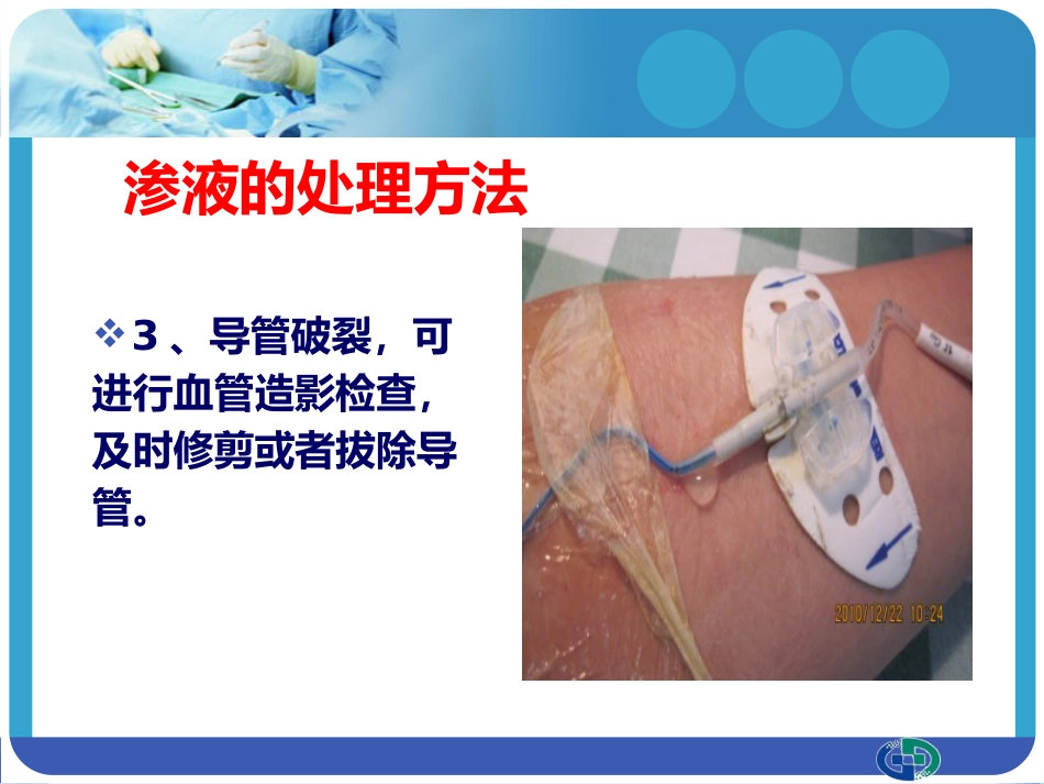PICC穿刺点渗液与皮肤过敏的处理_第14页