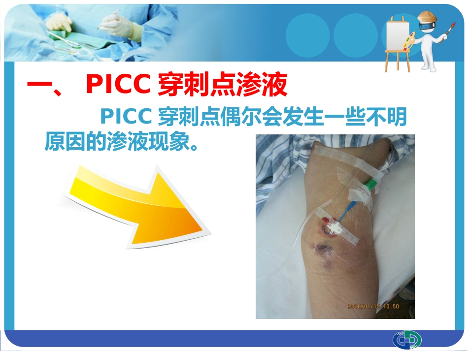 PICC穿刺点渗液与皮肤过敏的处理_第2页