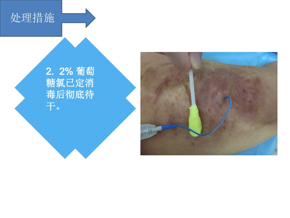 PICC过敏性皮炎个案汇报_第6页