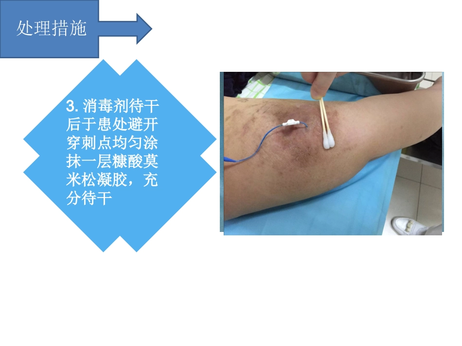 PICC过敏性皮炎个案汇报_第7页