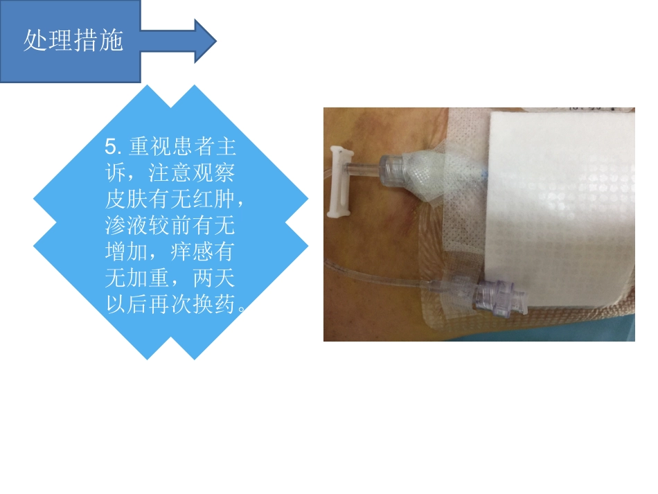 PICC过敏性皮炎个案汇报_第9页