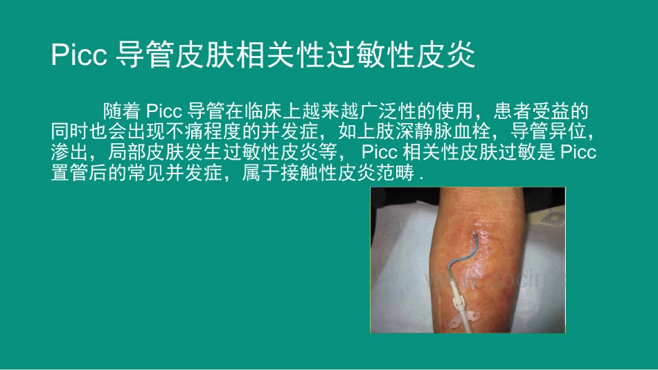 Picc导管皮肤相关性皮炎案例与分析_第3页