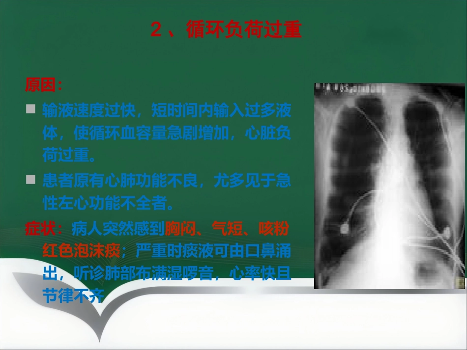 推荐输液反应过敏反应输血反应的处理流程_第15页