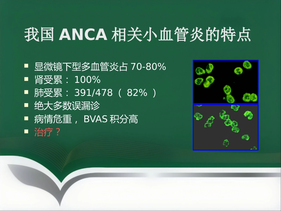 推荐ANCA相关性血管炎诊疗进展_第3页