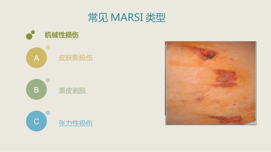 MARSI 医用黏胶相关皮肤损伤医学PPT课件_第15页
