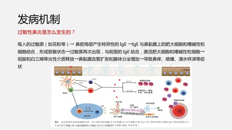 过敏性鼻炎诊断与治疗方案_第4页