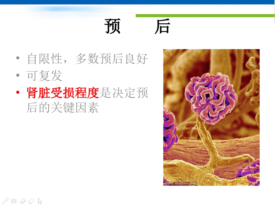 过敏性紫癜_第15页