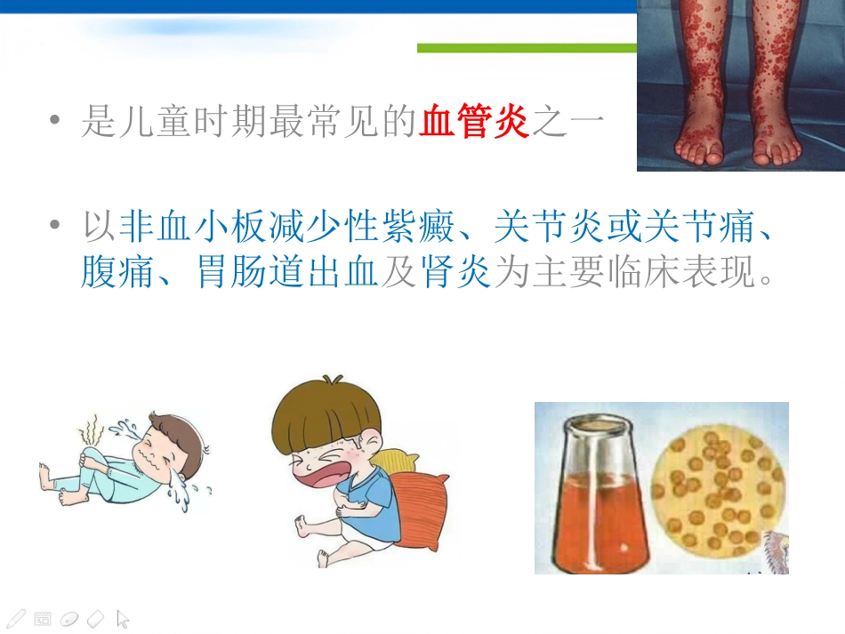 过敏性紫癜_第2页
